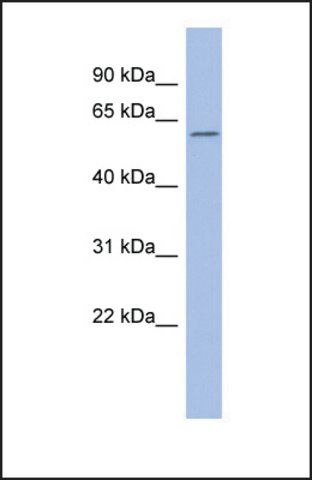 Anti-CACNB1 antibody produced in rabbit