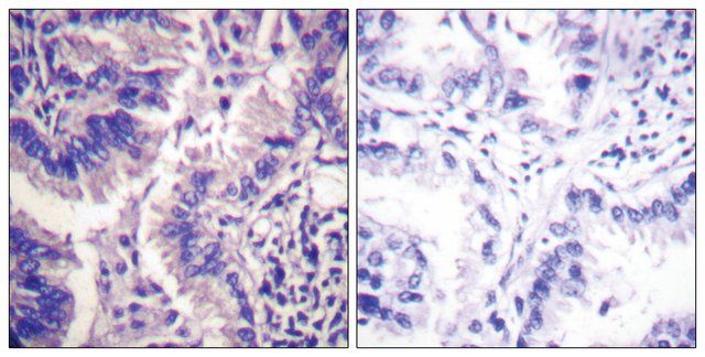 Anti-CASP9 (Cleaved-Asp<sup>315</sup>) antibody produced in rabbit