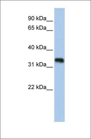 Anti-C6ORF140 antibody produced in rabbit