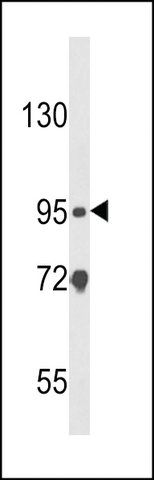 ANTI-CARD4(C-TERMINAL) antibody produced in rabbit