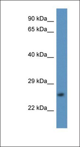 Anti-CAPNS2 antibody produced in rabbit