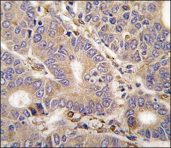 Anti-CARS2 (C-term) antibody produced in rabbit