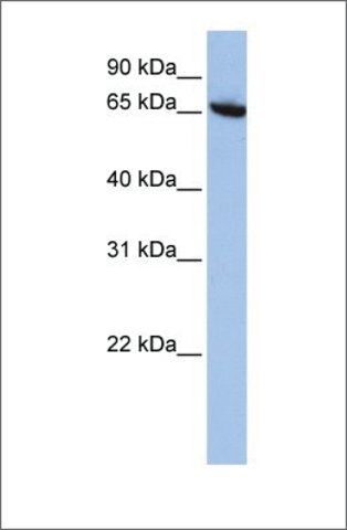 Anti-CBFA2T2 antibody produced in rabbit