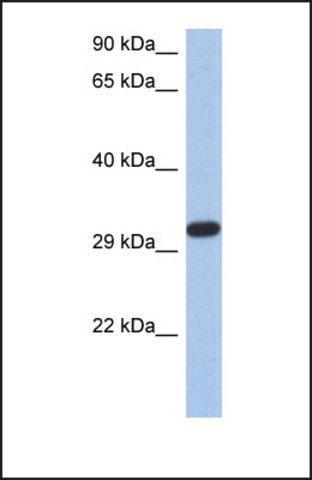 Anti-CAPZA3, (N-terminal) antibody produced in rabbit