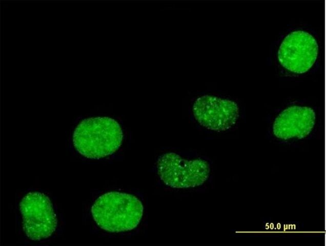 Anti-CBX5 antibody produced in mouse