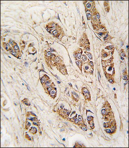 ANTI-CASC3 (Y181) antibody produced in rabbit