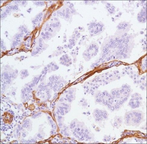 Anti-Caveolin-1 antibody, Rabbit monoclonal