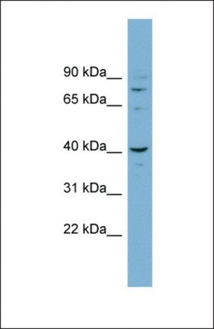 Anti-CASC3, (N-terminal) antibody produced in rabbit