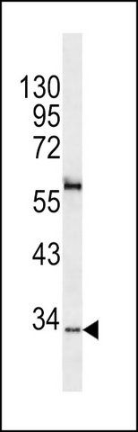 ANTI-CAPZA1 (N-TERM) antibody produced in rabbit