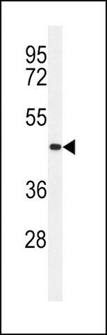 ANTI-CC50B (N-TERMINAL) antibody produced in rabbit