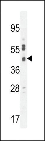 ANTI-CB018(C-TERMINAL) antibody produced in rabbit