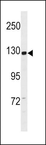 ANTI-CCD14(N-TERMINAL) antibody produced in rabbit