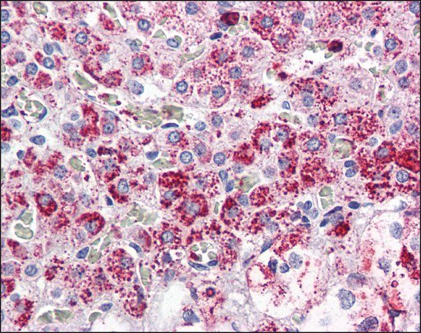 Anti-CCKAR antibody produced in rabbit