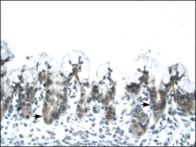 Anti-ACDC antibody produced in rabbit