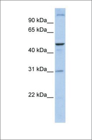 Anti-ACBD5 (ab1) antibody produced in rabbit