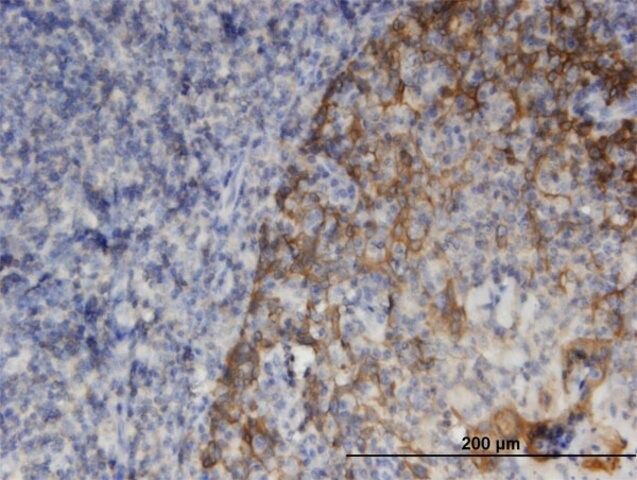 Monoclonal Anti-SNAPAP, (C-terminal) antibody produced in mouse