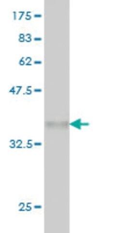 Monoclonal Anti-SNCAIP antibody produced in mouse