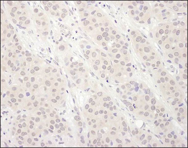 Rabbit anti-DDX56 Antibody, Affinity Purified