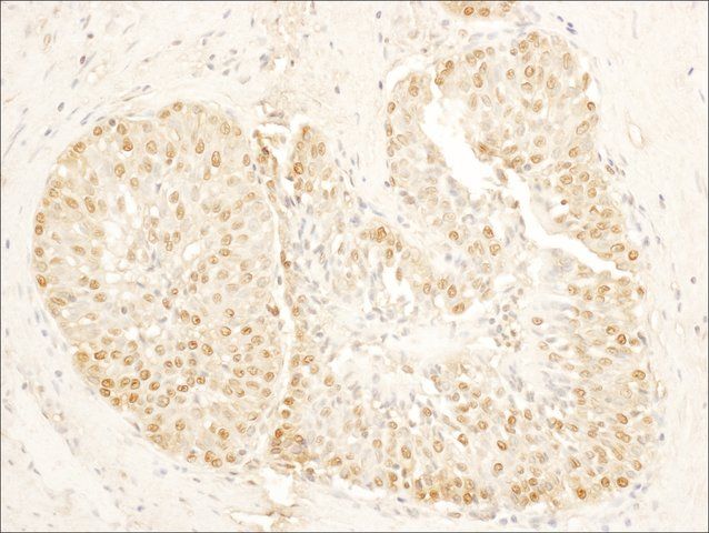 Rabbit anti-SA1 Antibody, Affinity Purified