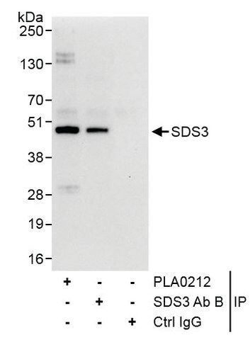 Rabbit anti-SDS3 Antibody, Affinity Purified