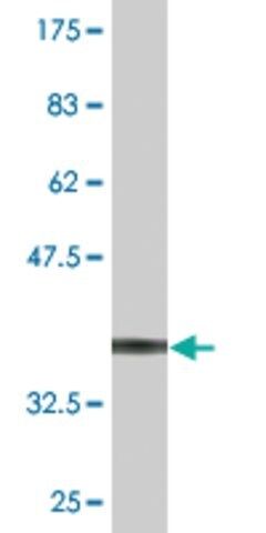 Monoclonal Anti-SLC26A9 antibody produced in mouse