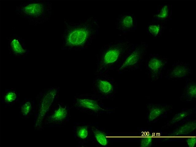 Monoclonal Anti-AK1 antibody produced in mouse