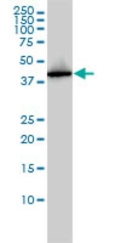 Monoclonal Anti-AHSA1 antibody produced in mouse