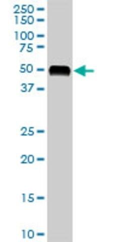 Monoclonal Anti-AGT antibody produced in mouse