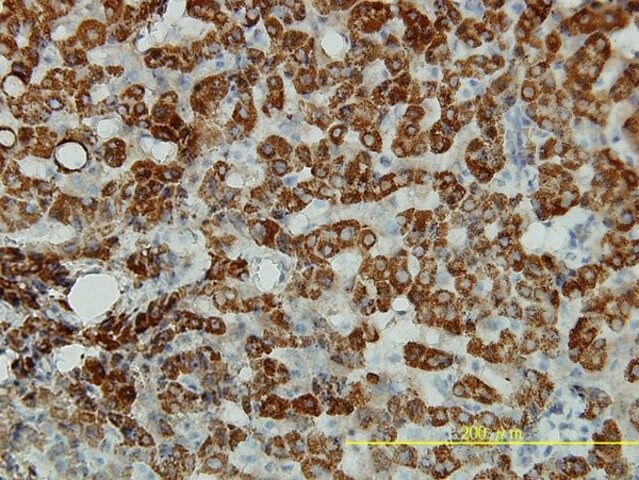 Monoclonal Anti-ALDH4A1 antibody produced in mouse