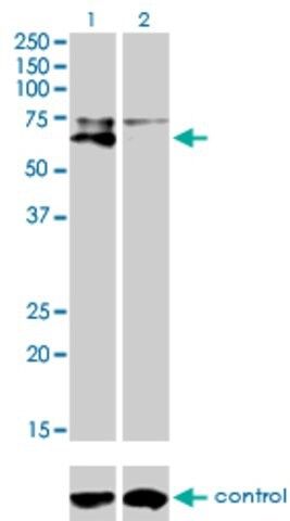 Monoclonal Anti-ALPL antibody produced in mouse