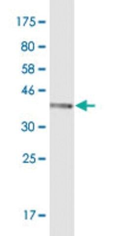 Monoclonal Anti-AKR1C1 antibody produced in mouse