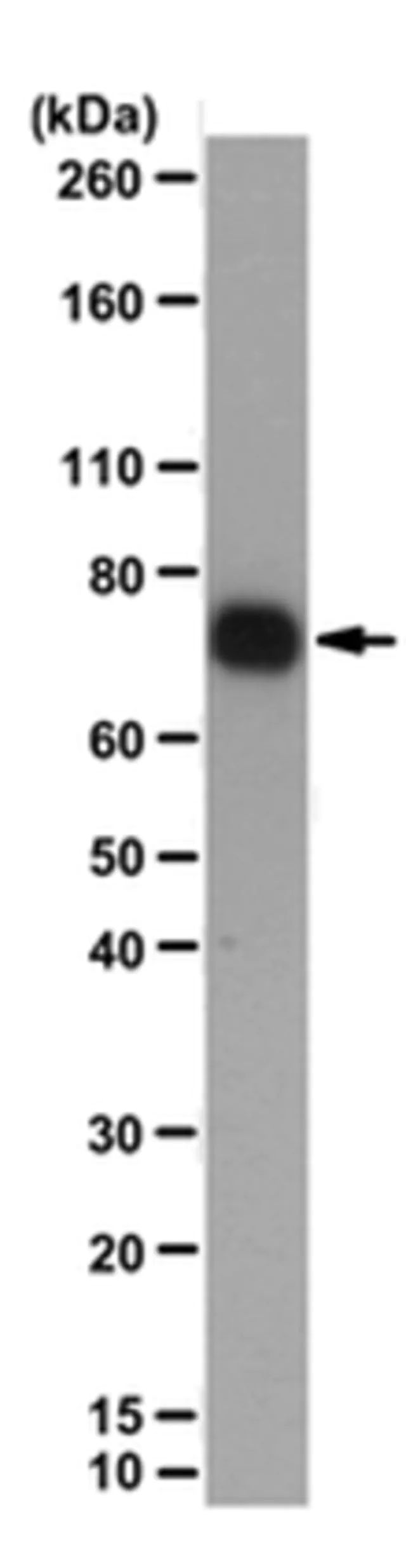 Anti-LIMD1 Antibody, clone 3F2/C6