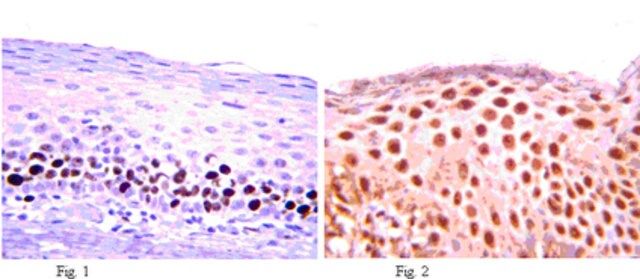 Anti-MEF2D Antibody