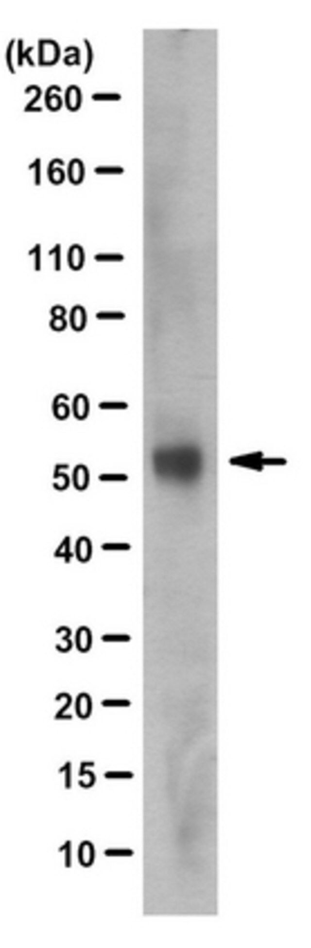 Anti-MGAT2 Antibody, clone 4A5.2