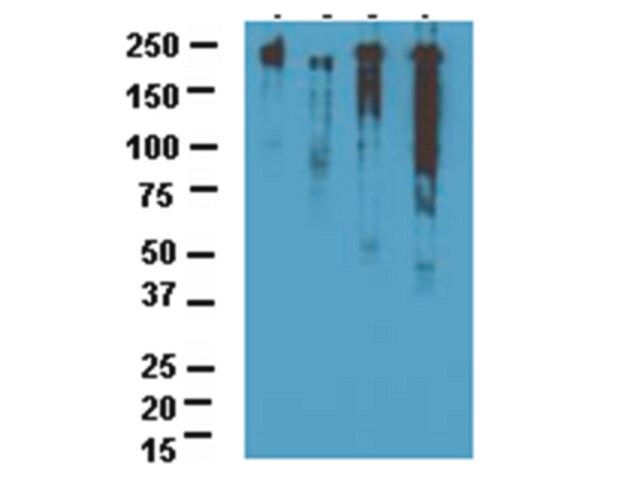 Anti-NOGO A Antibody