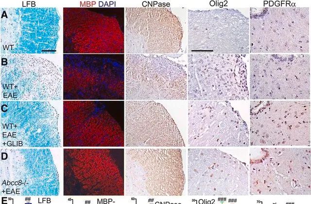 Anti-Olig2 Antibody, clone 211F1.1