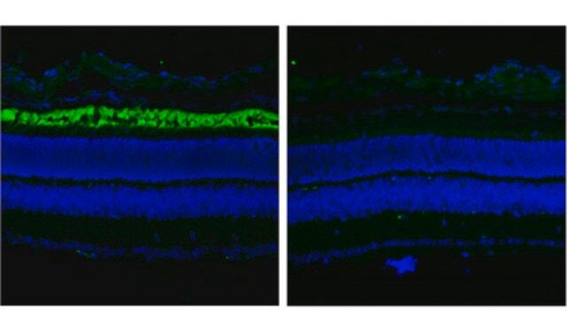 Anti-ABCA4 Antibody, clone TMR1