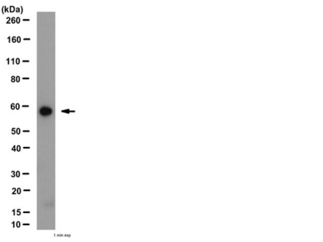 Anti-Angiopoietin-1 Antibody