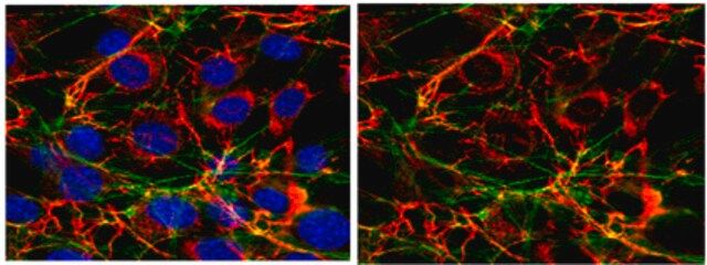 Anti-Fibronectin Antibody