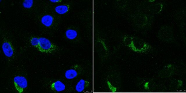 Anti-dsRNA Antibody, clone rJ2