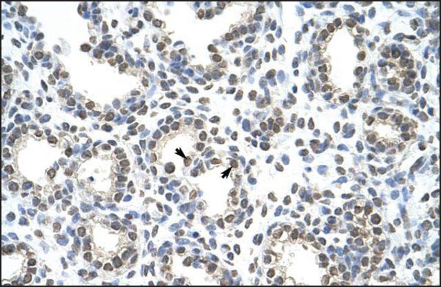 Anti-HNRPAB antibody produced in rabbit