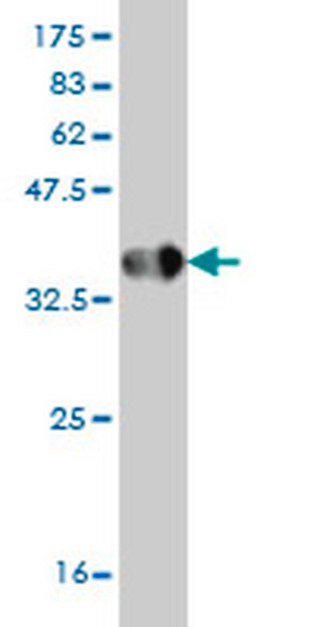 Anti-HPSE Mouse mAb (4D7)