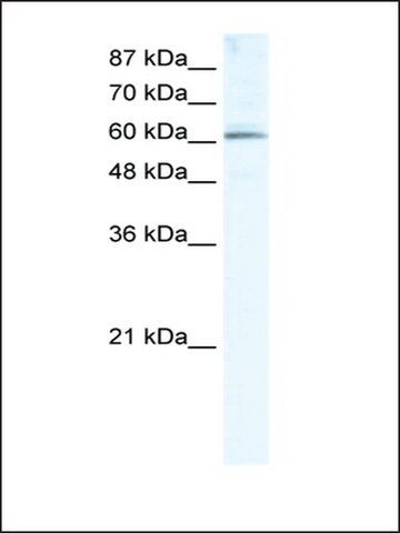 Anti-METTL3 (AB1) antibody produced in rabbit