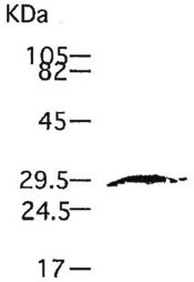 Anti-MMP-7 (Ab-1) Mouse mAb (141-7B2)