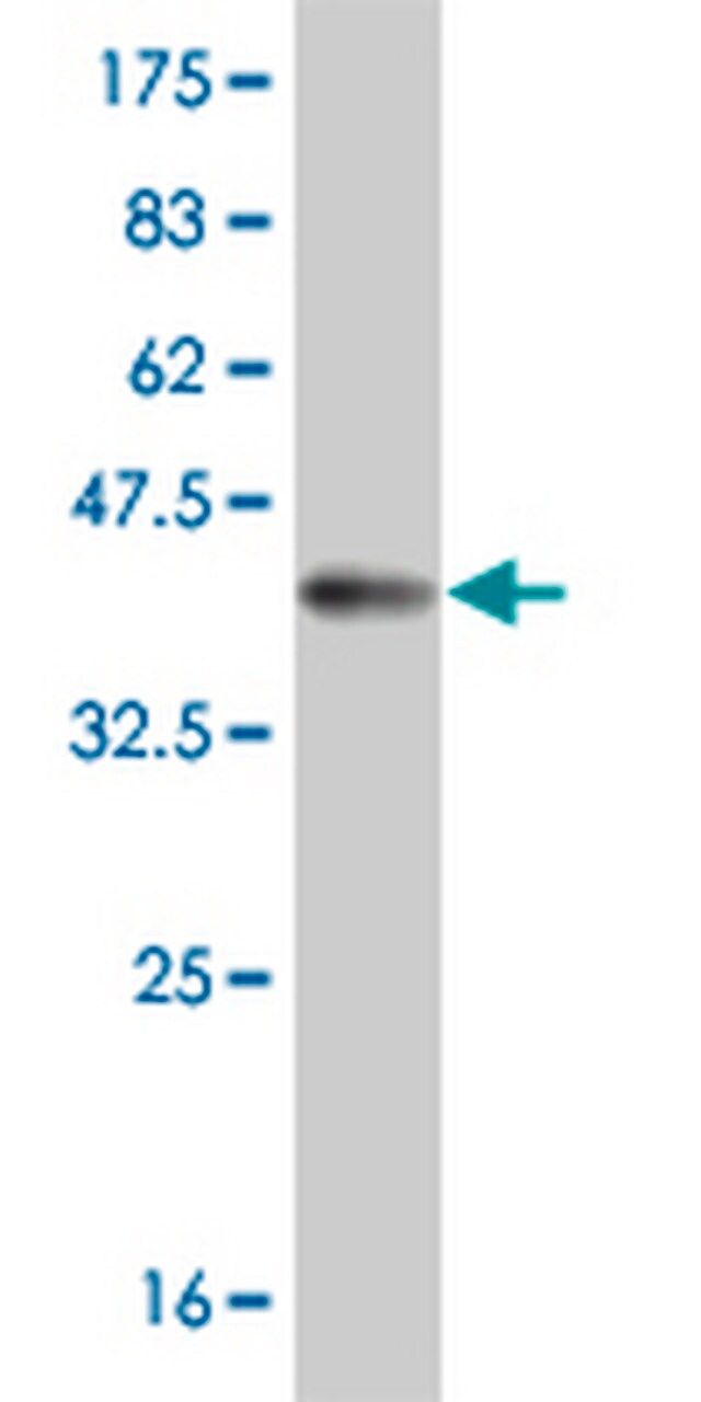 Anti-MSLN Mouse mAb (1A10)