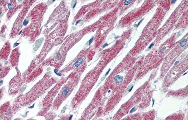 Anti-MAS1 (AB1) antibody produced in rabbit