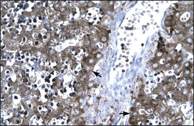 Anti-MMP19 (AB2) antibody produced in rabbit