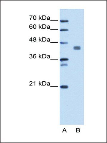 Anti-PDHA1 (AB2) antibody produced in rabbit