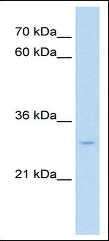 Anti-NR5A2 (AB2) antibody produced in rabbit