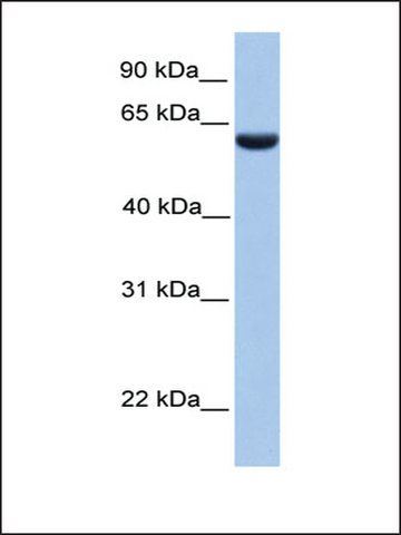 Anti-PHF1 (AB1) antibody produced in rabbit